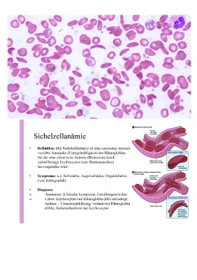 Sichelzellanämie