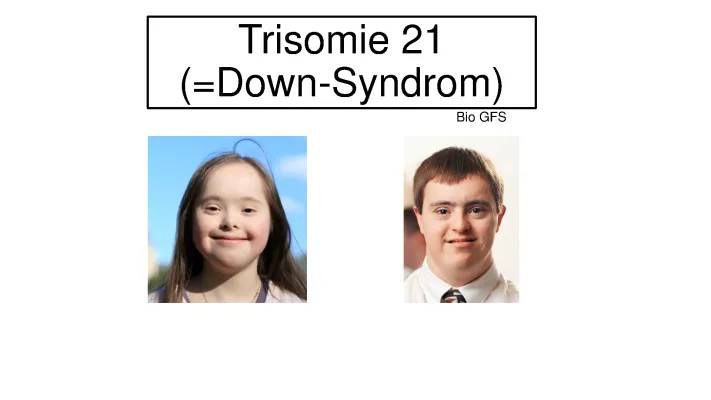 Trisomie 21: Alles über Symptome, Erkennung und Lebenserwartung für dein Baby