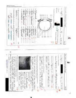 Das Auge Arbeitsblatt mit Lösungen - Klasse 9