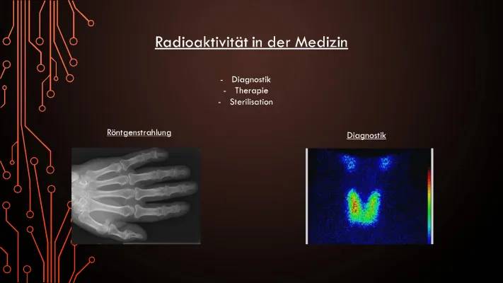 Radiojodtherapie und Strahlung: Spätfolgen, Gewichtszunahme und Haarausfall