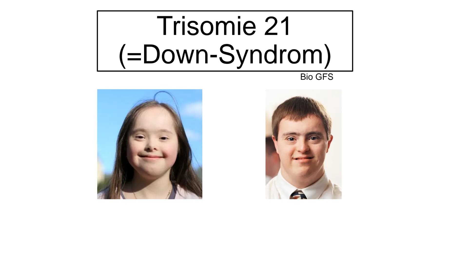 I
Was ist Trisomie 21?
angeborene Anomalie (=Abweichung) des Erbguts →→Genommutation, bei der das 21. Chromosom
dreimal vorhanden ist →→ Bet