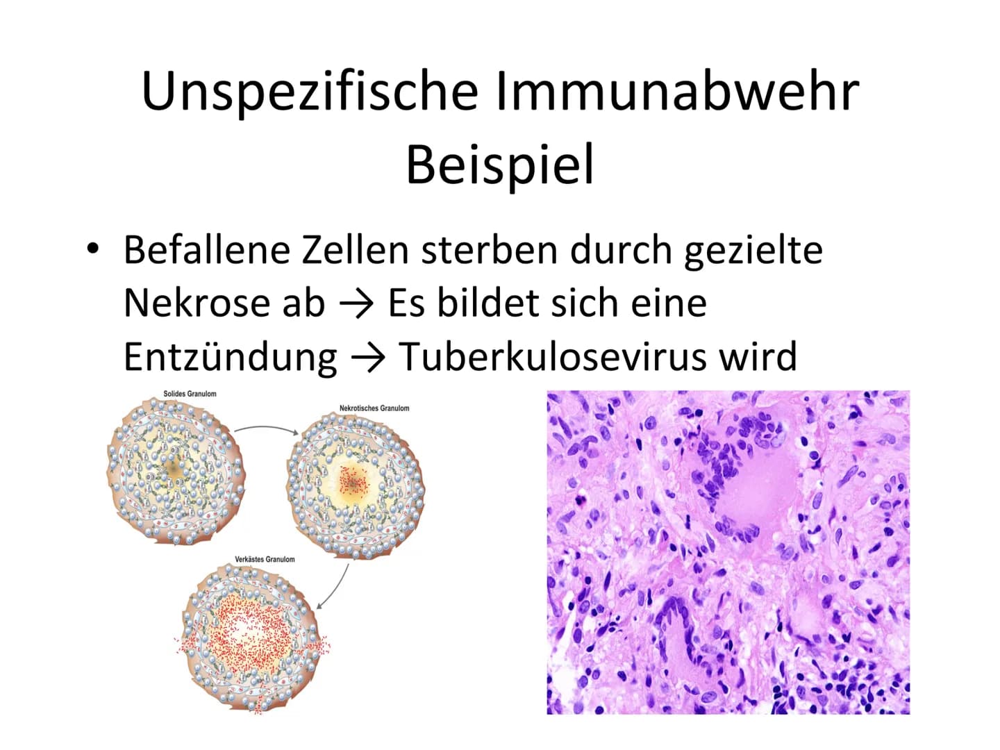 Unspezifische Immunabwehr &
Erst- und Zweitinfektion Gliederung
Unspezifische Immunabwehr
Definition
-
- Allgemeine Abwehr
- Selektive Abweh