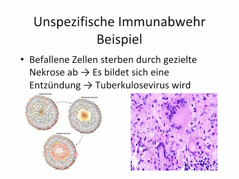 Unspezifische Immunabwehr &
Erst- und Zweitinfektion Gliederung
Unspezifische Immunabwehr
Definition
-
- Allgemeine Abwehr
- Selektive Abweh