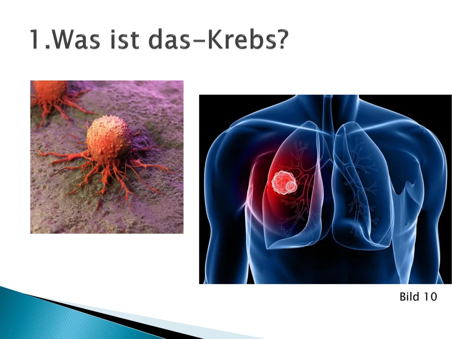 Neuerkrankungen*
Sterbefälle
0-4
5-9
10-14
15-19
20-24
25-29
30-34
35-39
40-44
45-49
50-54
55-59
60-64
69-99
70-74
75-79
80-84
85+
0
500
100