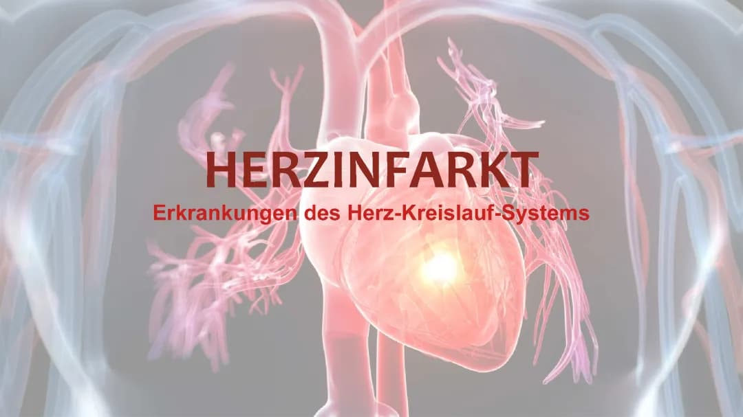 Herzinfarkt