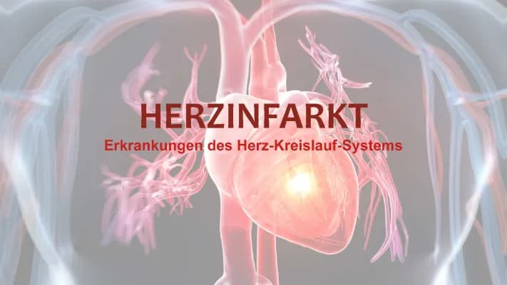 Know Herzinfarkt thumbnail