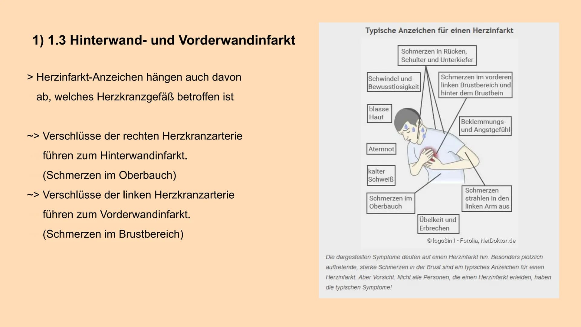HERZINFARKT
Erkrankungen des Herz-Kreislauf-Systems INHALTSVERZEICHNIS
1. Symptome
1.1 Klassische Anzeichen
1.2 weitere typische Symptome
1.