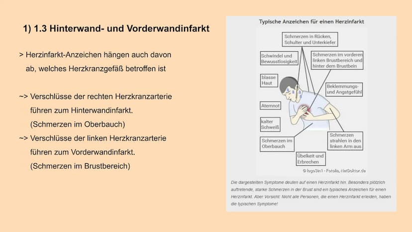 HERZINFARKT
Erkrankungen des Herz-Kreislauf-Systems INHALTSVERZEICHNIS
1. Symptome
1.1 Klassische Anzeichen
1.2 weitere typische Symptome
1.
