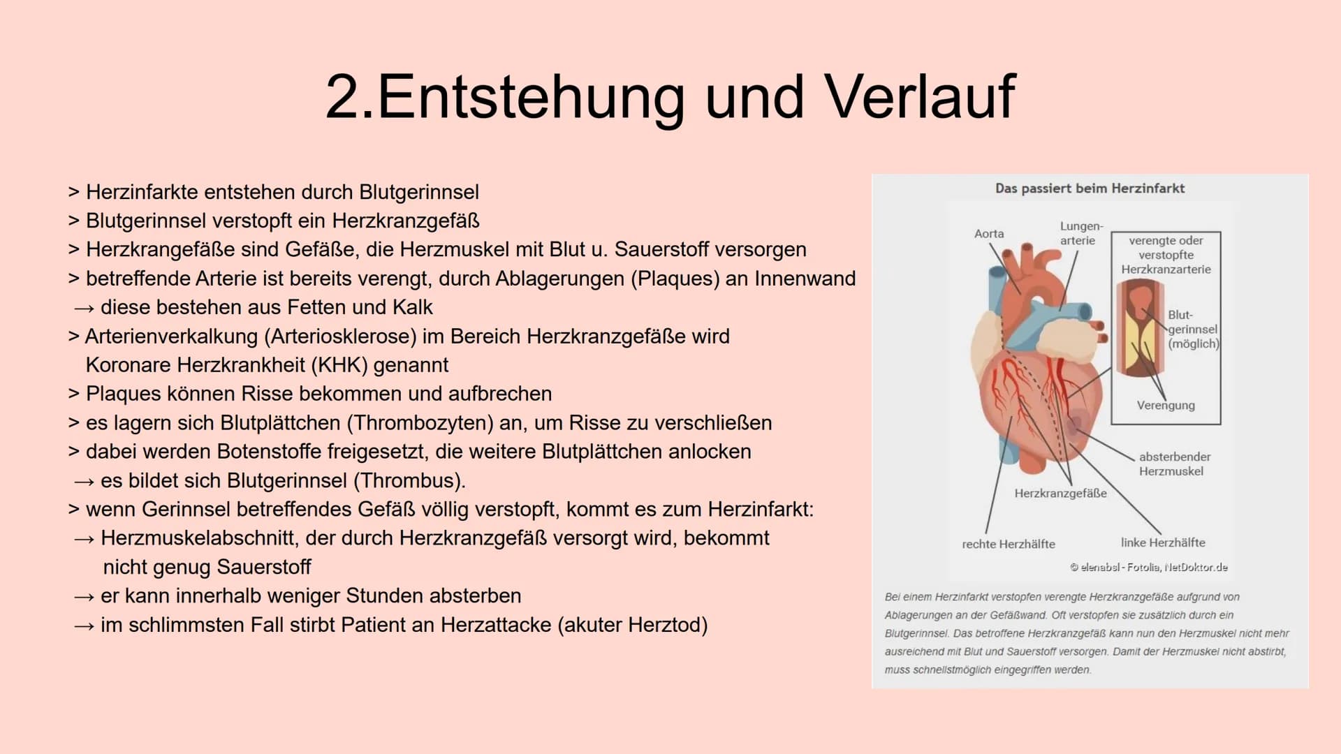 HERZINFARKT
Erkrankungen des Herz-Kreislauf-Systems INHALTSVERZEICHNIS
1. Symptome
1.1 Klassische Anzeichen
1.2 weitere typische Symptome
1.