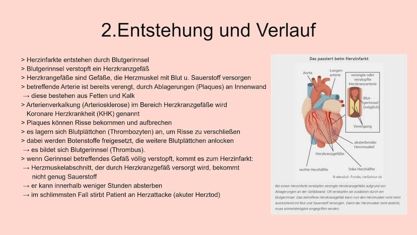 HERZINFARKT
Erkrankungen des Herz-Kreislauf-Systems INHALTSVERZEICHNIS
1. Symptome
1.1 Klassische Anzeichen
1.2 weitere typische Symptome
1.
