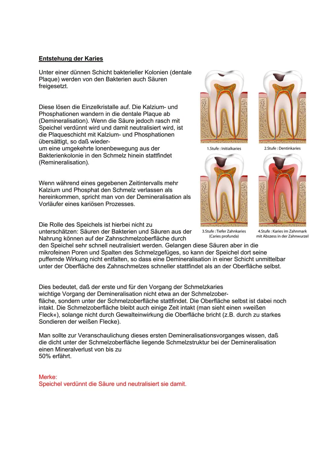 Entstehung der Karies
Unter einer dünnen Schicht bakterieller Kolonien (dentale
Plaque) werden von den Bakterien auch Säuren
freigesetzt.
Di
