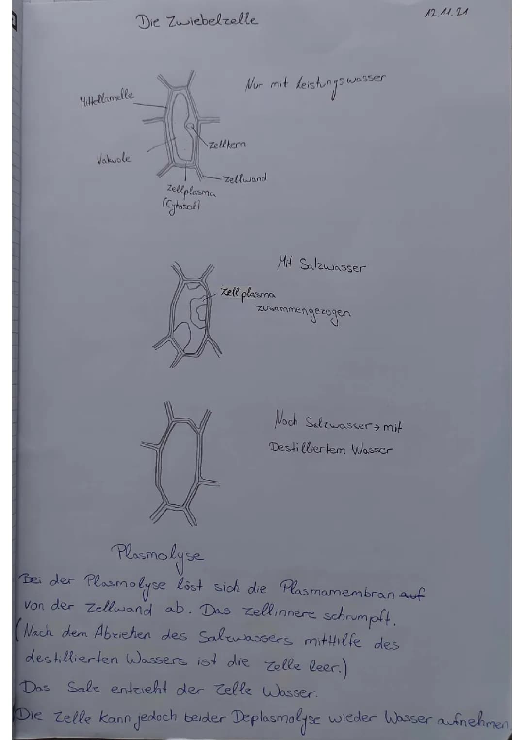 Plasmolyse an der Zwiebelzelle
