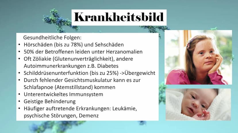 Trisomie 21
ہو Allgemeine Infos
Gliederung
Krankheitsbild
Häufigkeit in
der
Bevölkerung
Art der
Mutation
Therapie Allgemeine Infos
• Viele v