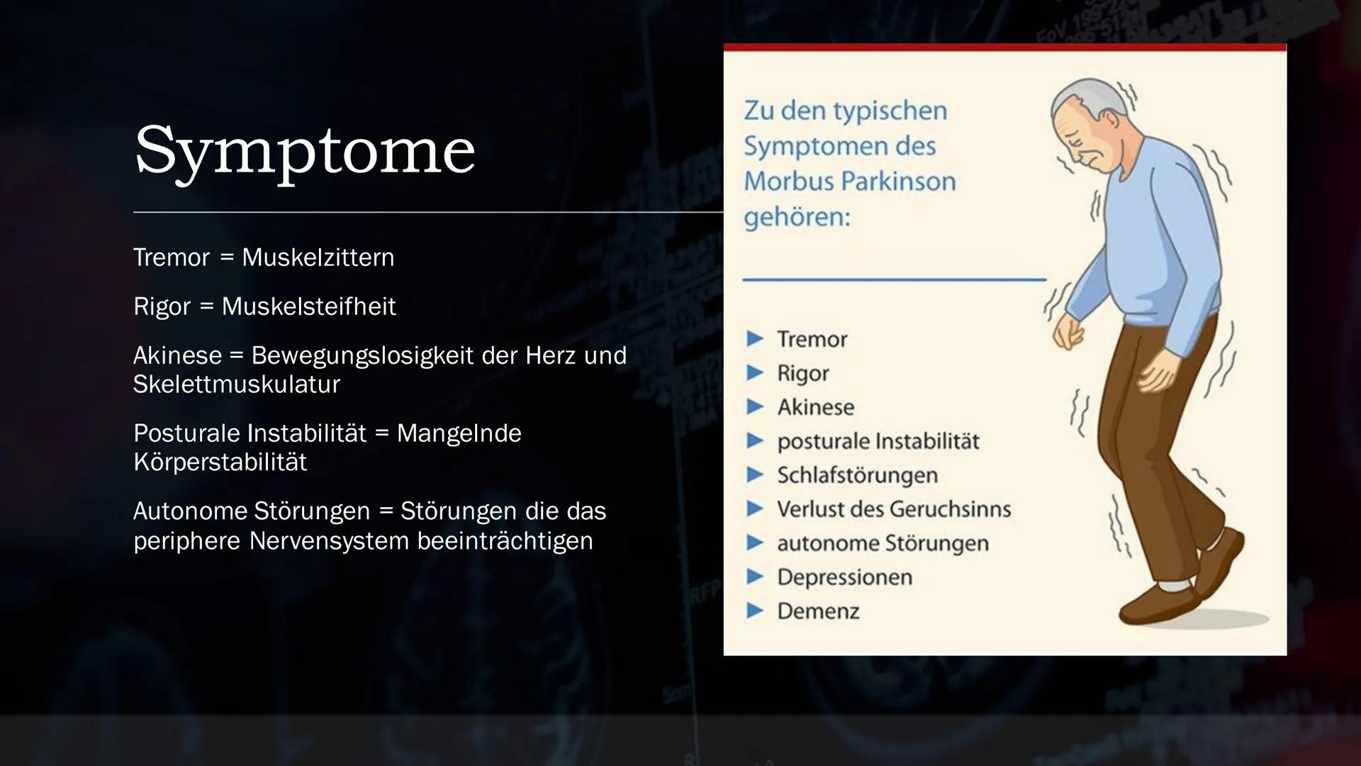 Parkinson
EIN REFERAT VON
BIO LK, Q1
23/180
OKES
LOX
2008 63
STUDY1
B91191
16.11.56
2 MA 18
RFP
5cm
AF
33
296 512
BASSA
667
FOV 199
Tra>Cor(