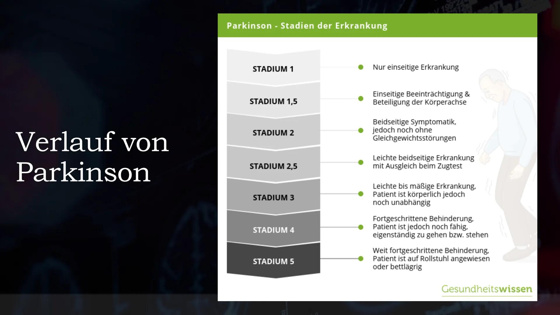 Parkinson
EIN REFERAT VON
BIO LK, Q1
23/180
OKES
LOX
2008 63
STUDY1
B91191
16.11.56
2 MA 18
RFP
5cm
AF
33
296 512
BASSA
667
FOV 199
Tra>Cor(