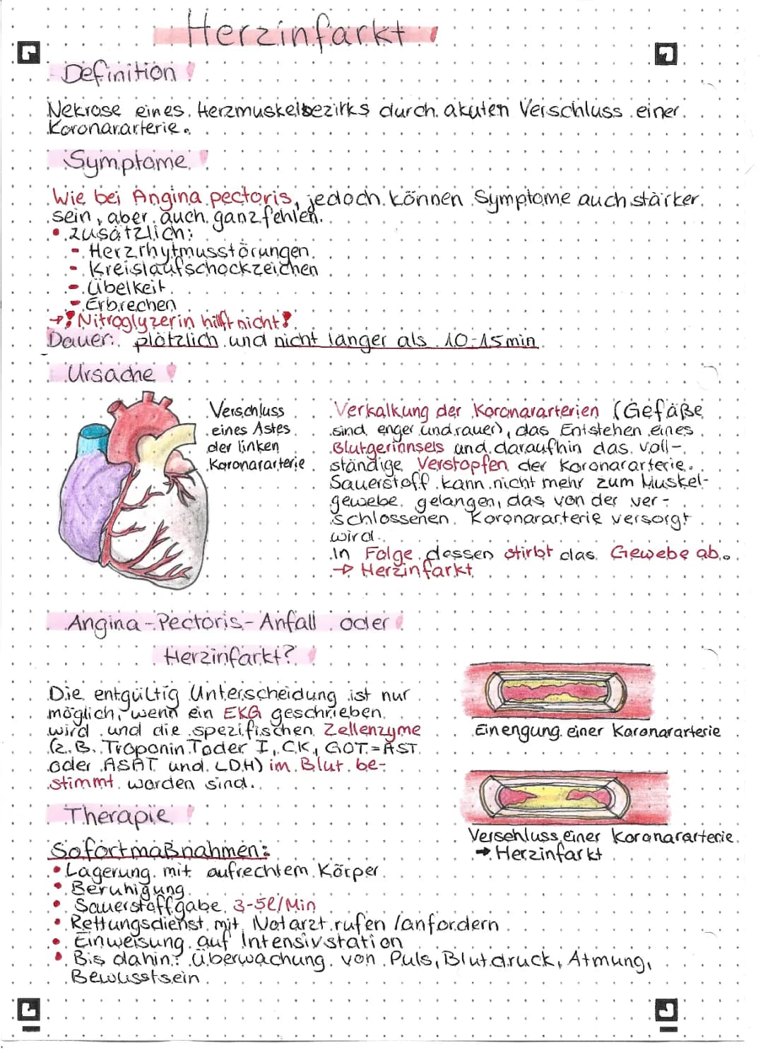 Herzinfarkt