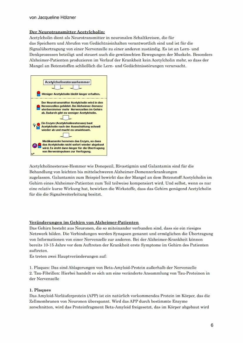 von Jacqueline Hölzner
Alzheimer
Einleitung
Aufgrund des demografischen Wandels, der Tatsache, dass die Menschen immer älter werden,
vor all