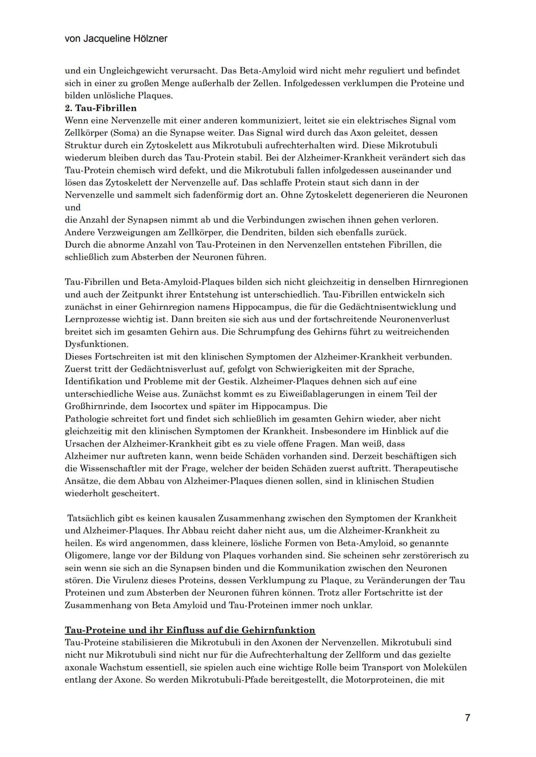 von Jacqueline Hölzner
Alzheimer
Einleitung
Aufgrund des demografischen Wandels, der Tatsache, dass die Menschen immer älter werden,
vor all