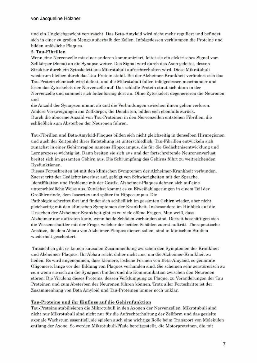 von Jacqueline Hölzner
Alzheimer
Einleitung
Aufgrund des demografischen Wandels, der Tatsache, dass die Menschen immer älter werden,
vor all