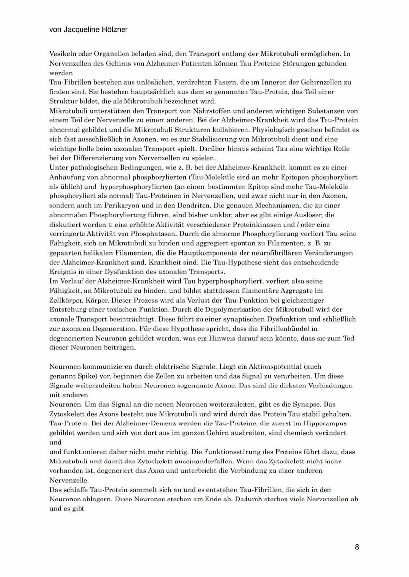 von Jacqueline Hölzner
Alzheimer
Einleitung
Aufgrund des demografischen Wandels, der Tatsache, dass die Menschen immer älter werden,
vor all