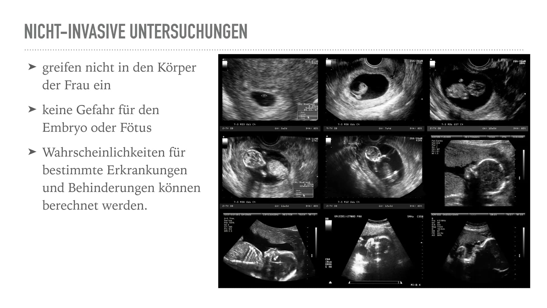 PRÄNATALDIAGNOSTIK WAS IST PRÄNATALDIAGNOSTIK?
Pränataldiagnostik oder PND sind vorgeburtliche Untersuchungen, welche Aussagen
über bestimmt