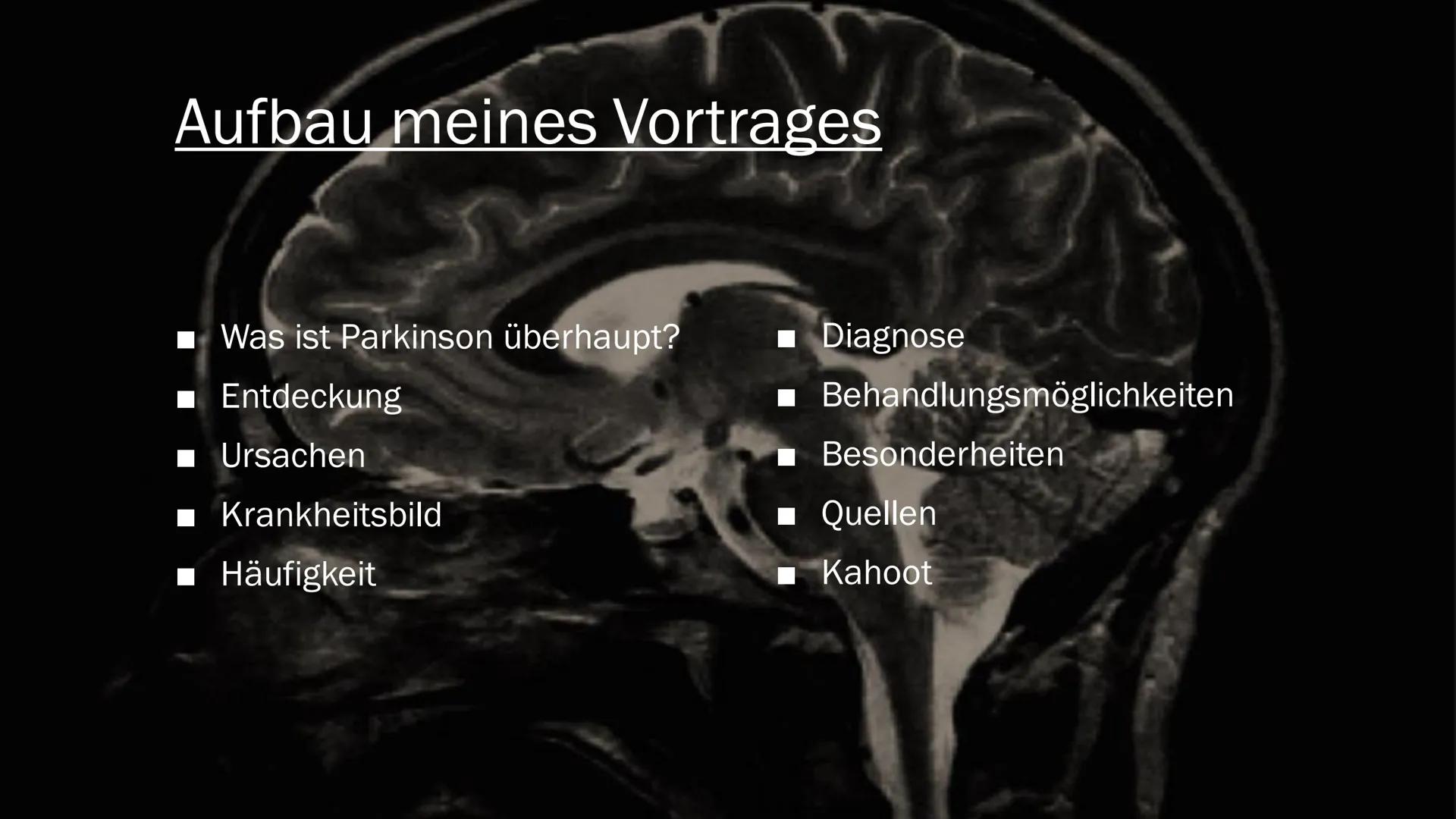 PARKINSON

R

L # Aufbau meines Vortrages

- Was ist Parkinson überhaupt?
- Entdeckung
- Ursachen
- ■ Krankheitsbild
- Häufigkeit
- ■ Diagno