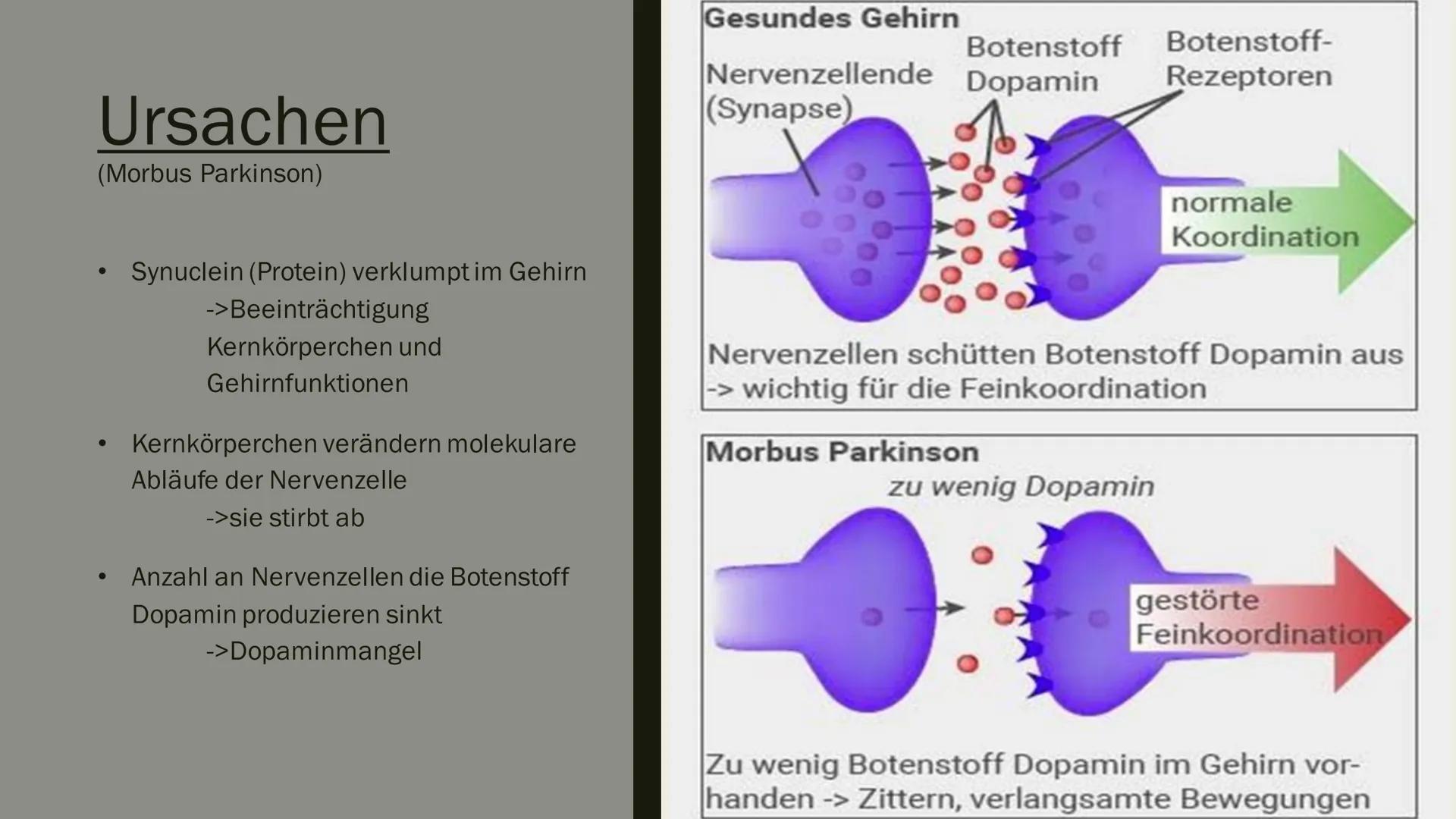 PARKINSON

R

L # Aufbau meines Vortrages

- Was ist Parkinson überhaupt?
- Entdeckung
- Ursachen
- ■ Krankheitsbild
- Häufigkeit
- ■ Diagno