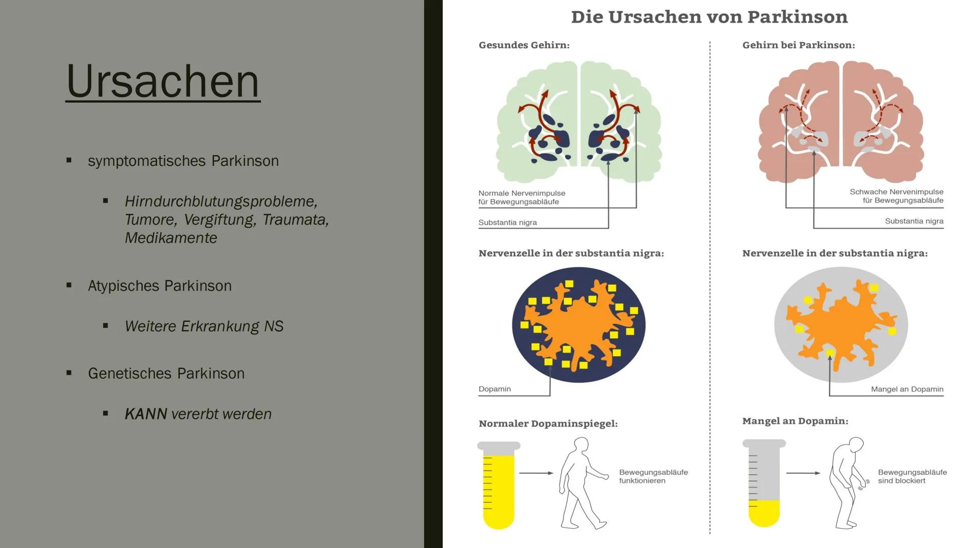 PARKINSON

R

L # Aufbau meines Vortrages

- Was ist Parkinson überhaupt?
- Entdeckung
- Ursachen
- ■ Krankheitsbild
- Häufigkeit
- ■ Diagno