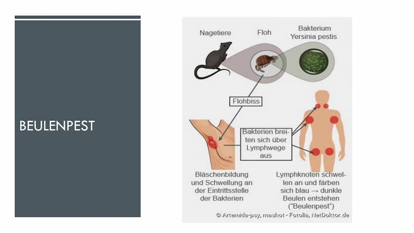 DIE PEST
5
fequal porton
Re GLIEDERUNG
•Allgemeines
•Vorbeugung
Quiz
•Erreger
•Behandlung
Mittelalter
•Übertragung
•Geschichte
•Symptome
•Pe