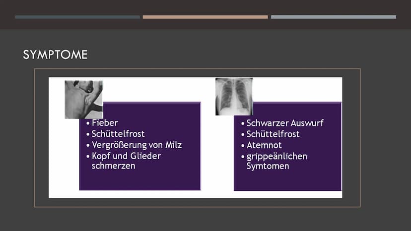 DIE PEST
5
fequal porton
Re GLIEDERUNG
•Allgemeines
•Vorbeugung
Quiz
•Erreger
•Behandlung
Mittelalter
•Übertragung
•Geschichte
•Symptome
•Pe