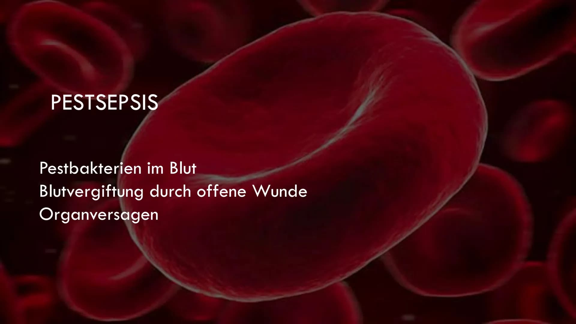 DIE PEST
5
fequal porton
Re GLIEDERUNG
•Allgemeines
•Vorbeugung
Quiz
•Erreger
•Behandlung
Mittelalter
•Übertragung
•Geschichte
•Symptome
•Pe