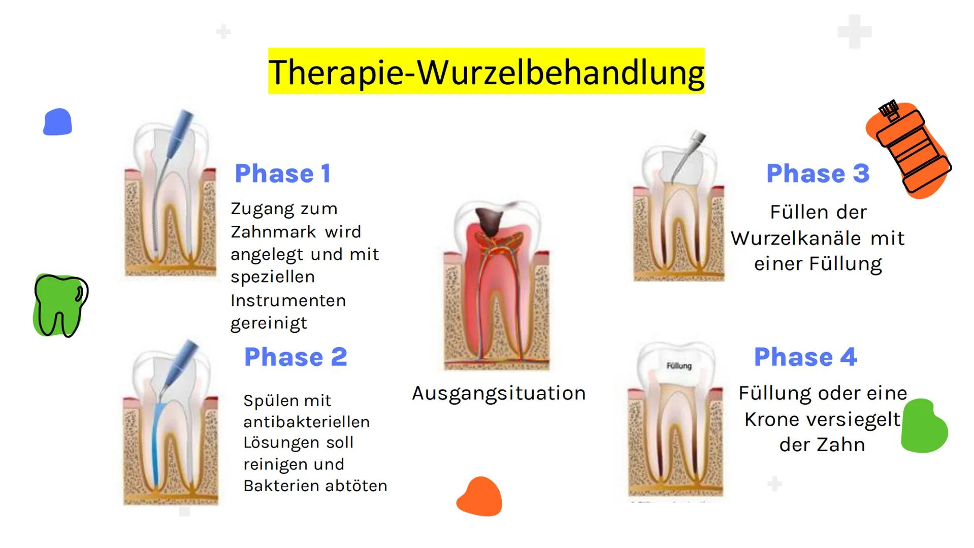 W
Pulpitis
Iva Georgievska M
1.
2.
3.
Was ist
Pulpitis?
Ursachen
Gliederung
Diagnostik
4. Symptome
5. Therapie + Was ist
Pulpitis?
Unter der