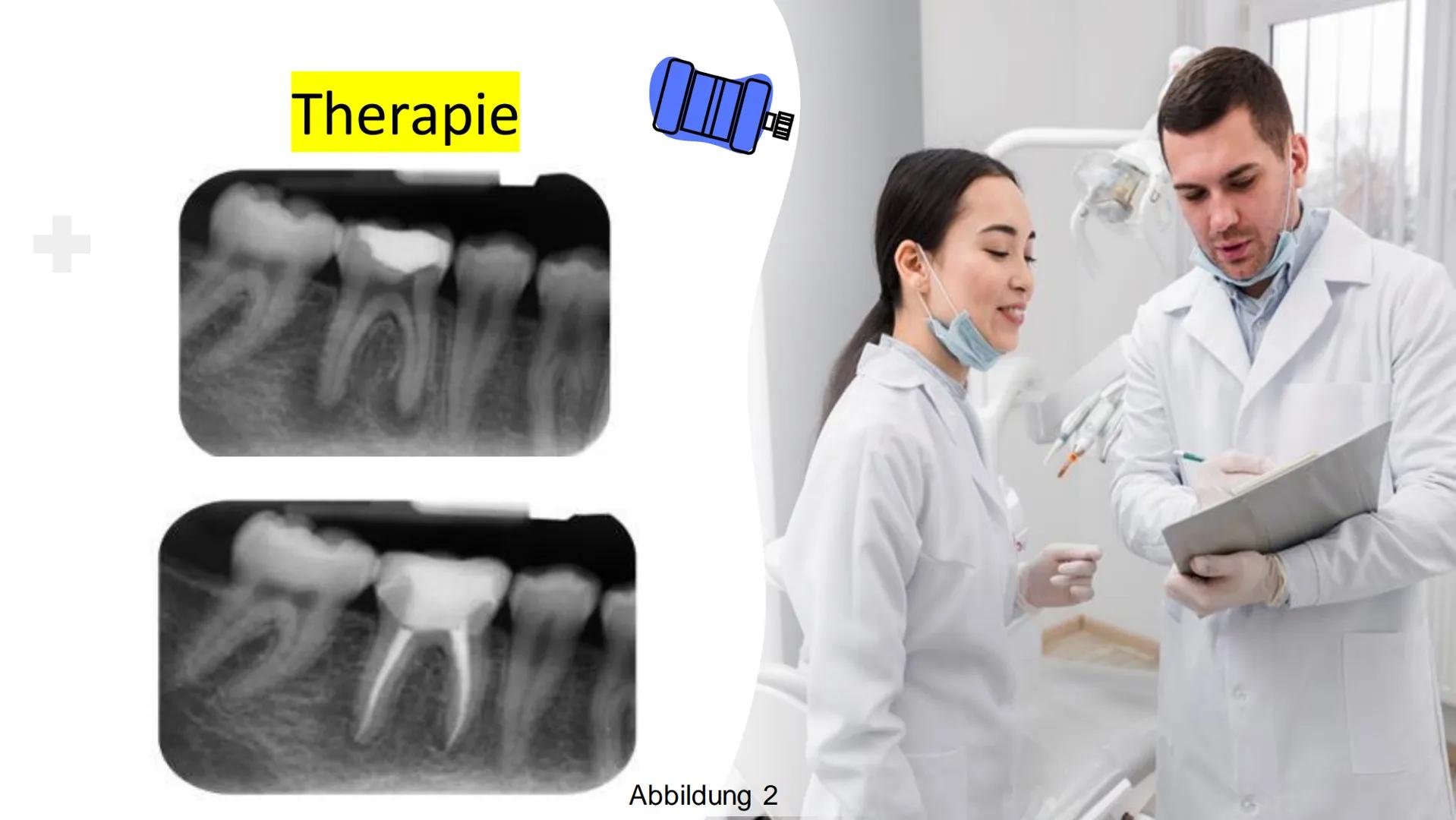 W
Pulpitis
Iva Georgievska M
1.
2.
3.
Was ist
Pulpitis?
Ursachen
Gliederung
Diagnostik
4. Symptome
5. Therapie + Was ist
Pulpitis?
Unter der