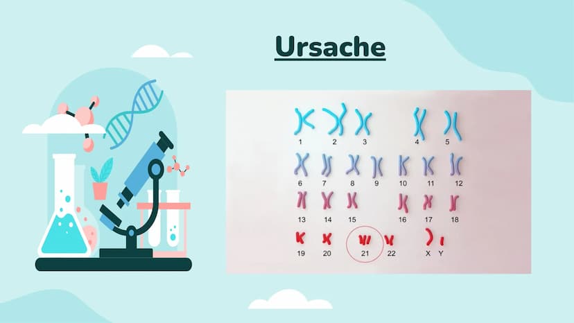 Down-Syndrom
!!!!!
PA Gliederung
- Was ist Trisomie 21?
-
Entdeckung
- Ursache
- Enstehung
- Körperliche Auffälligkeiten
- Behandlung
- Vork