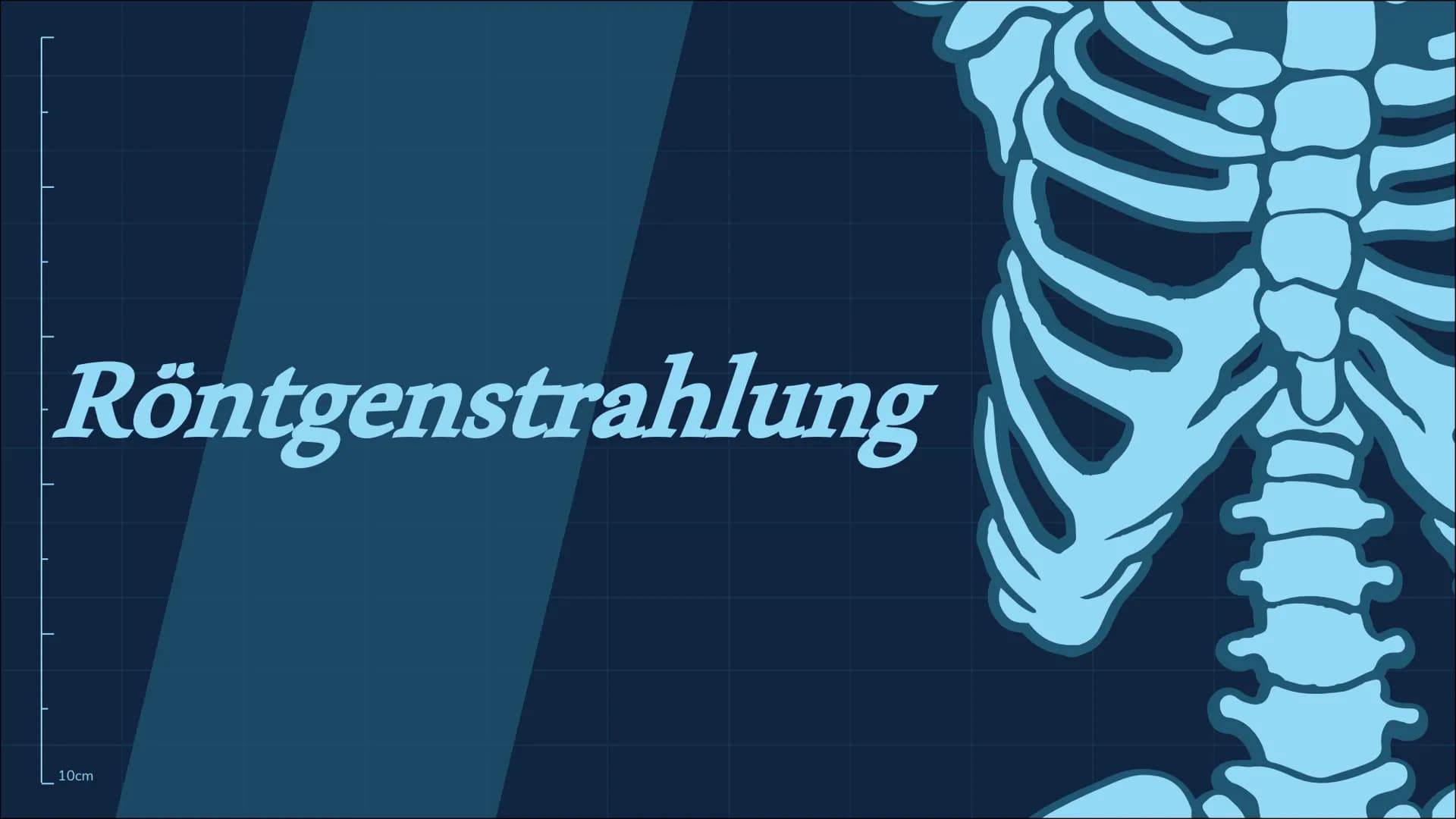 Röntgenstrahlung
10cm
n 01
02
Röntgenstrahlen-/Eigenschaften Entdeckung-/Entstehung
10cm
Themen
03
Verwendungen
04
05
Gefahren Zusammenfassu