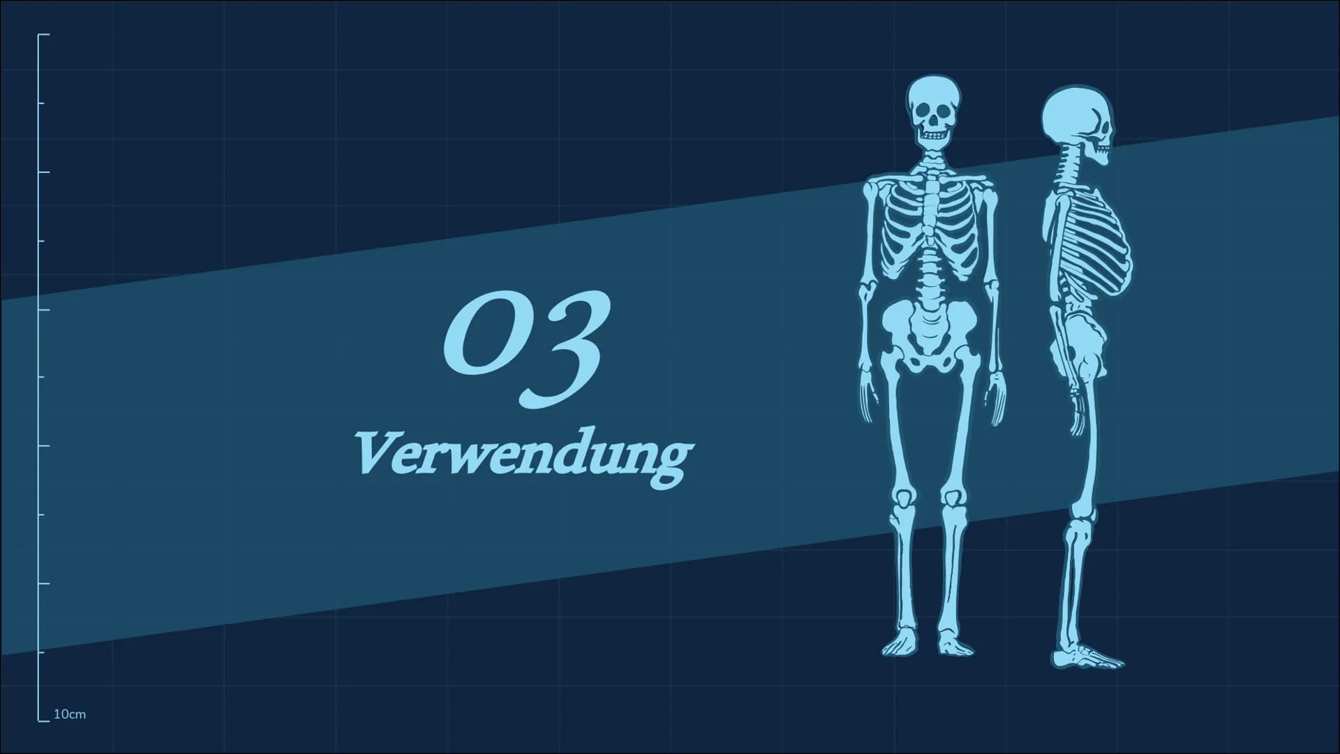 Röntgenstrahlung
10cm
n 01
02
Röntgenstrahlen-/Eigenschaften Entdeckung-/Entstehung
10cm
Themen
03
Verwendungen
04
05
Gefahren Zusammenfassu