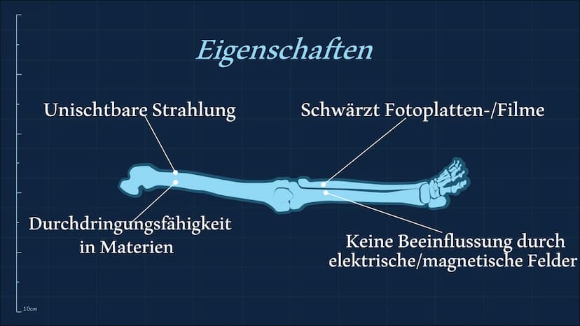 Röntgenstrahlung
10cm
n 01
02
Röntgenstrahlen-/Eigenschaften Entdeckung-/Entstehung
10cm
Themen
03
Verwendungen
04
05
Gefahren Zusammenfassu