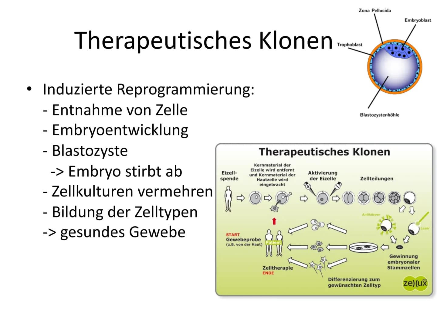 Menschliches Klonen
Frankensteins Traum wird wahr
Aus normalen Körperzellen können Forscher nun die Kopie
eines Menschen herstellen. Darf da