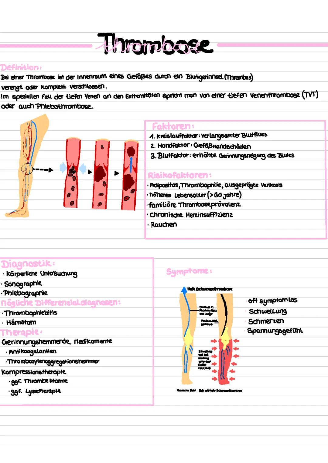 Thrombose
