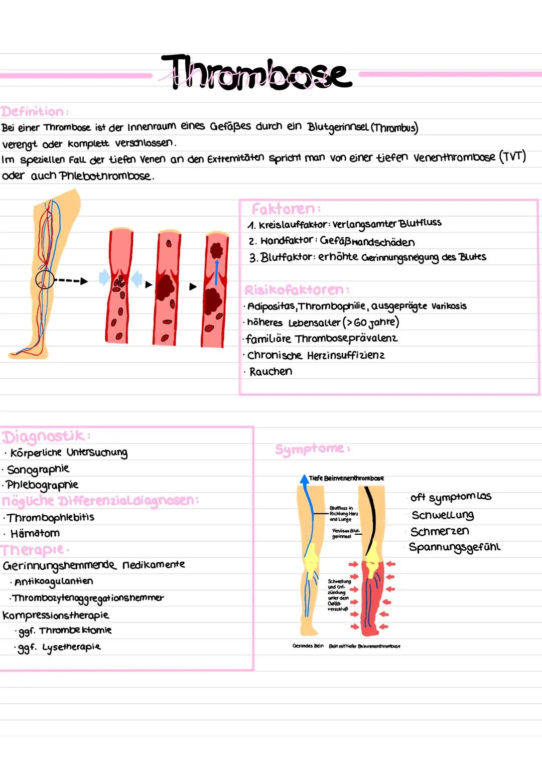 Thrombose
Definition:
Bei einer Thrombose ist der Innenraum eines Gefäßes durch ein Blutgerinnsel (Thrombus)
verengt oder komplett verschlos