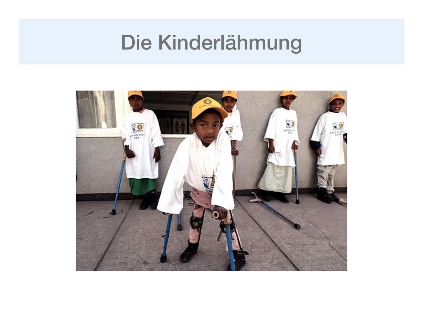 1. Einleitung
Wie auch in den 1980er Jahren AIDS ein sehr großes Thema war, prägte in
den 1950er Jahren auch die Angst vor der Kinderlähmung