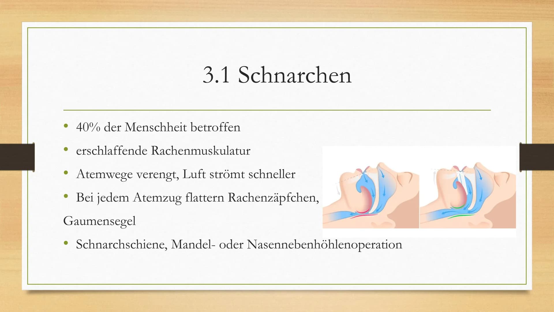 Schlafstörungen 1.
2. Schlaf
3. Schlafstörungen
3.1 Schnarchen
3.2 Schlafapnoe
3.3 Narkolepsie
3.4 Zirkadiane
3.5 Parasomnie
Einleitung
4. M