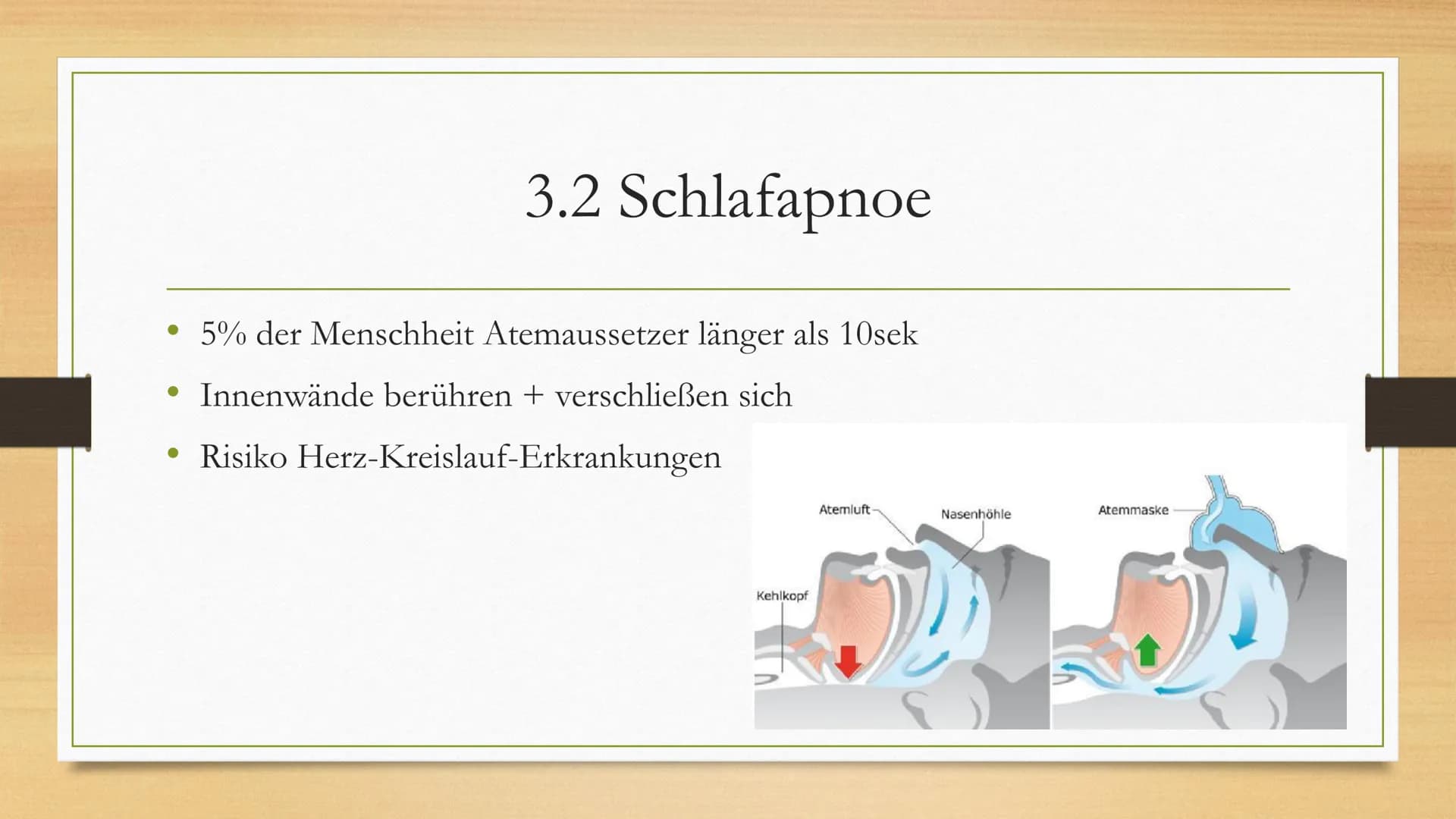 Schlafstörungen 1.
2. Schlaf
3. Schlafstörungen
3.1 Schnarchen
3.2 Schlafapnoe
3.3 Narkolepsie
3.4 Zirkadiane
3.5 Parasomnie
Einleitung
4. M