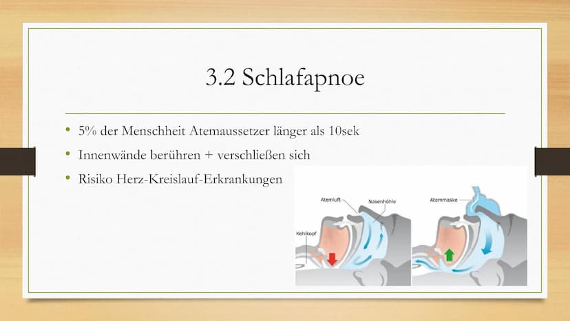 Schlafstörungen 1.
2. Schlaf
3. Schlafstörungen
3.1 Schnarchen
3.2 Schlafapnoe
3.3 Narkolepsie
3.4 Zirkadiane
3.5 Parasomnie
Einleitung
4. M