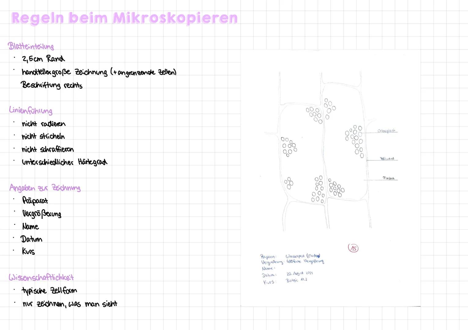 # Mikroskop-Typen

|                   | Cichtmikroskop          | Elektronen mikroskop    | Rosterelektronen mikroshop | STED-Mikroskop    