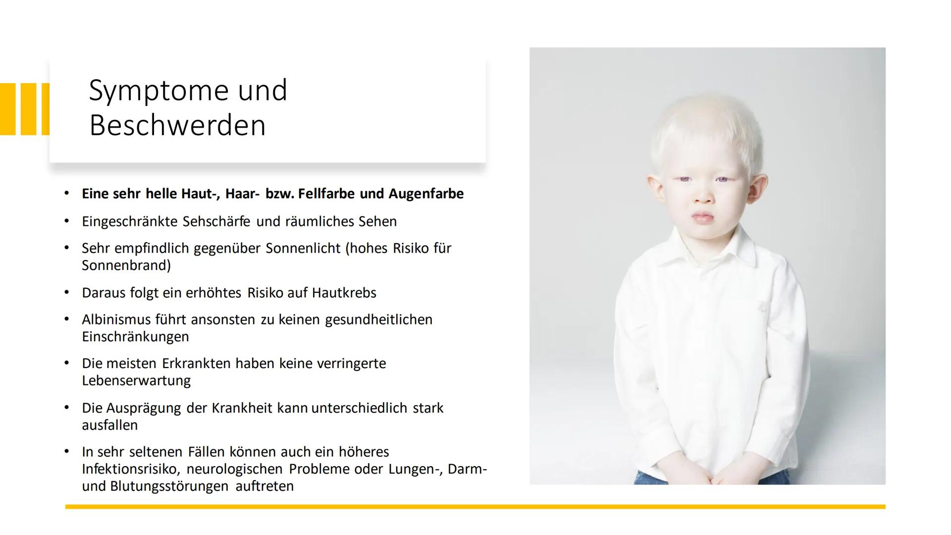 Albinismus Inhaltsverzeichnis
Was ist Albinismus?
Symptome und Beschwerden
• Genetische Ursachen / Erbgang
●
Unterschiedliche Formen des Alb
