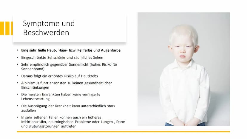 Albinismus Inhaltsverzeichnis
Was ist Albinismus?
Symptome und Beschwerden
• Genetische Ursachen / Erbgang
●
Unterschiedliche Formen des Alb