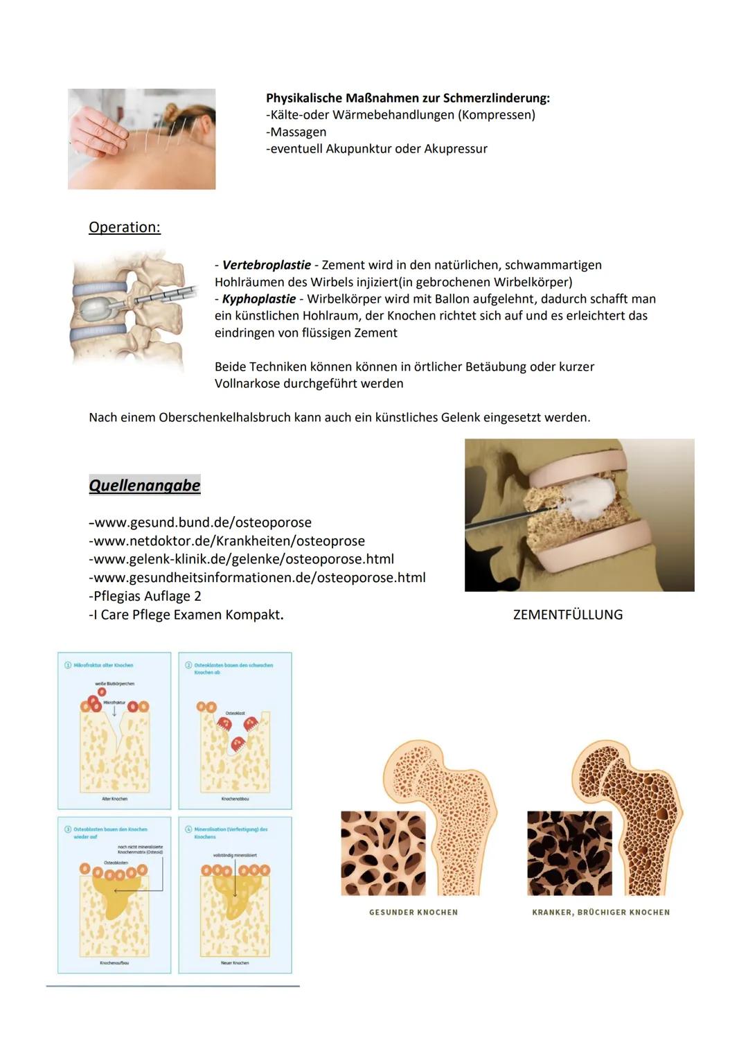 # Osteoporose

Definition

Ist ein Krankhafter Knochenschwund, bei dem die Knochenmasse mehr abgebaut als neu gebildet
wird. Dadurch sinkt d