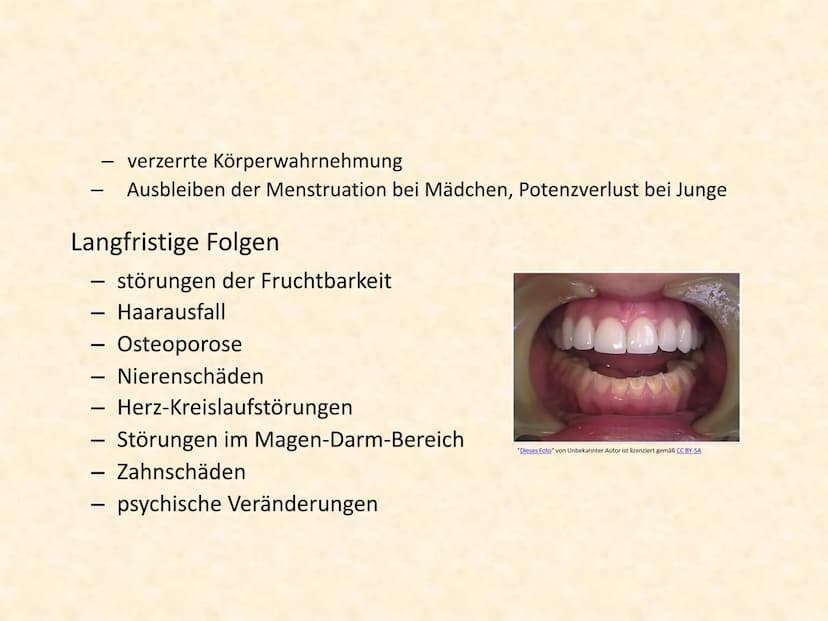 Magersucht
Eine Präsentation über die häufigste
Essstörung der Welt Inhalt
Essstörungen allgemein
Ursachen
Magersucht
Magersucht bei Kindern