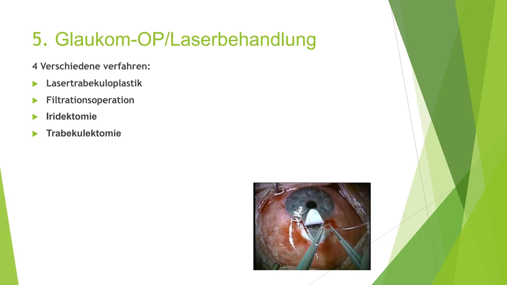 Der grüne Star
(Glaukom) Gliederung
1. Was ist ein Glaukom
2. Symptome
3. Arten von Glaukomen
4. Entstehung
5. Behandlung
6. Quellen
Geschäd